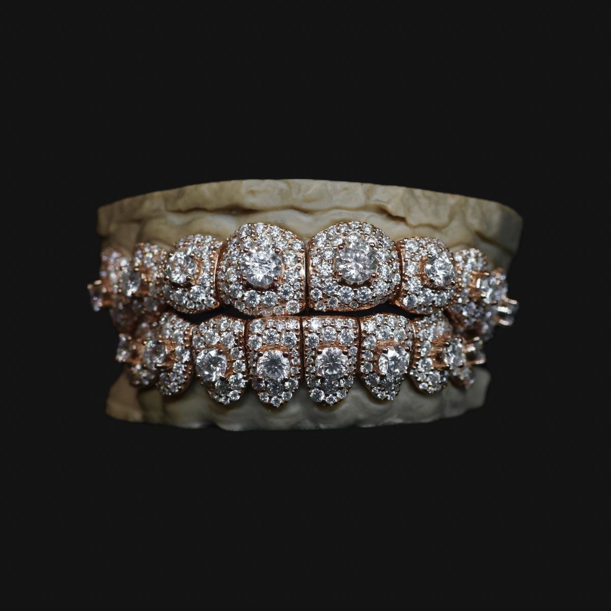 CENTER SET GRILLZ